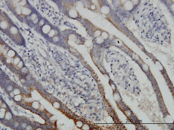 DLD monoclonal antibody (M04), clone 1G11