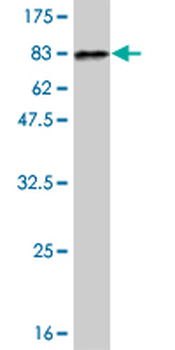 DLD monoclonal antibody (M04), clone 1G11
