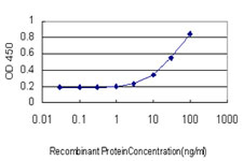 DLD monoclonal antibody (M02), clone 3C1