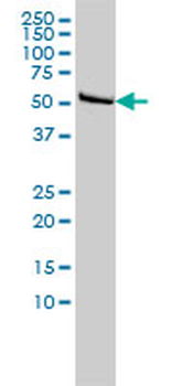 DLD monoclonal antibody (M02), clone 3C1