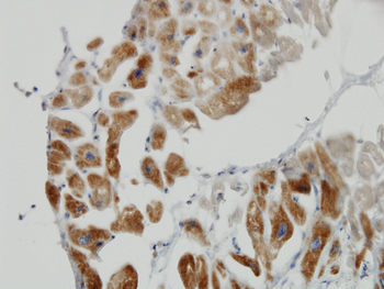 DLD monoclonal antibody (M02), clone 3C1