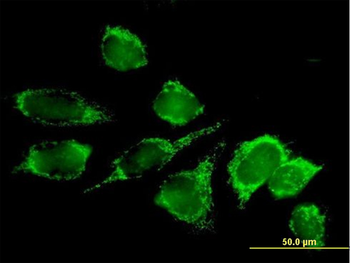 DLAT purified MaxPab mouse polyclonal antibody (B01P)