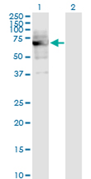 DKC1 monoclonal antibody (M04), clone 3E10