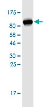 DKC1 monoclonal antibody (M04), clone 3E10
