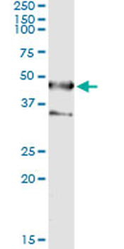 SEPT1 monoclonal antibody (M03), clone 1F12