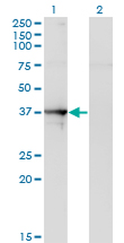 SEPT1 monoclonal antibody (M03), clone 1F12