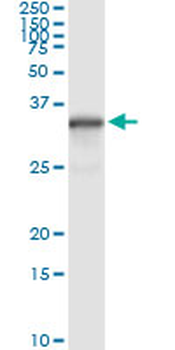 NQO1 monoclonal antibody (M01), clone 1E3-A6