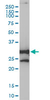 NQO1 monoclonal antibody (M01), clone 1E3-A6