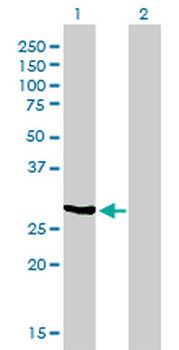 NQO1 monoclonal antibody (M01), clone 1E3-A6