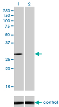 NQO1 monoclonal antibody (M01), clone 1E3-A6