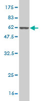 NQO1 monoclonal antibody (M01), clone 1E3-A6