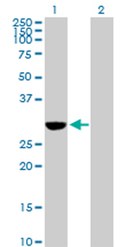 NQO1 purified MaxPab rabbit polyclonal antibody (D01P)