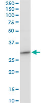 CYB5R3 polyclonal antibody (A01)