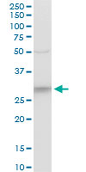 CYB5R3 polyclonal antibody (A01)