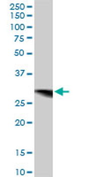 CYB5R3 polyclonal antibody (A01)