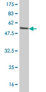 CYB5R3 polyclonal antibody (A01)