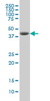 DHODH monoclonal antibody (M01), clone 6E1