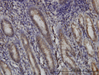 DHODH monoclonal antibody (M01), clone 6E1