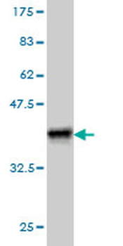 DHODH monoclonal antibody (M01), clone 6E1