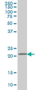 DHFR monoclonal antibody (M01), clone 2B10