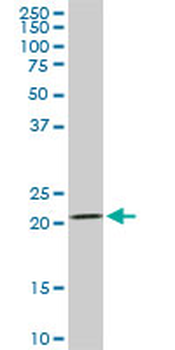 DHFR monoclonal antibody (M01), clone 2B10