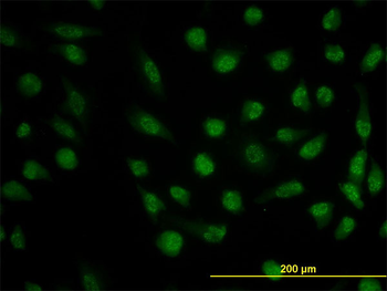 DHFR monoclonal antibody (M01), clone 2B10