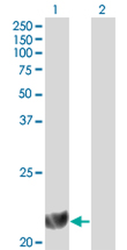 DHFR monoclonal antibody (M01), clone 2B10