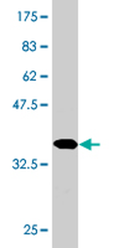 DHFR monoclonal antibody (M01), clone 2B10