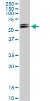 DHCR7 purified MaxPab rabbit polyclonal antibody (D01P)