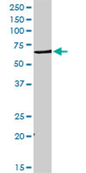 DHCR7 purified MaxPab rabbit polyclonal antibody (D01P)
