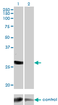DGUOK monoclonal antibody (M02), clone 3E9