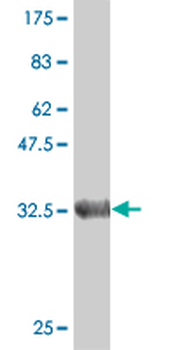 DGUOK monoclonal antibody (M02), clone 3E9