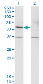 DFNA5 monoclonal antibody (M01), clone 1E10