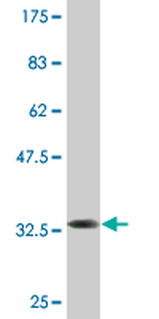 TIMM8A monoclonal antibody (M04), clone 1A12