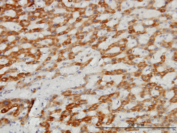 TIMM8A monoclonal antibody (M01), clone 2F11