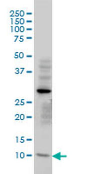 TIMM8A monoclonal antibody (M01), clone 2F11
