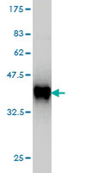 TIMM8A monoclonal antibody (M01), clone 2F11
