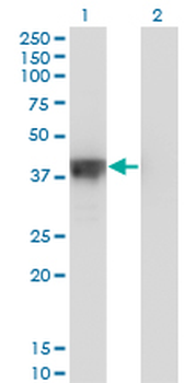 DFFA monoclonal antibody (M05), clone 3A11
