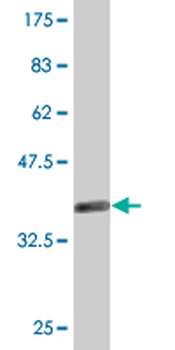 DFFA monoclonal antibody (M05), clone 3A11