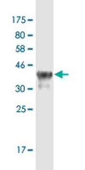 DEFA6 monoclonal antibody (M01), clone 2D2