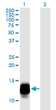 DEFA3 monoclonal antibody (M01), clone 1A9