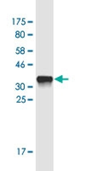 DEFA3 monoclonal antibody (M01), clone 1A9