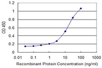 DECR1 monoclonal antibody (M01), clone 3D4