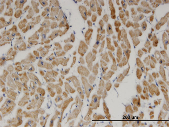 DECR1 monoclonal antibody (M01), clone 3D4