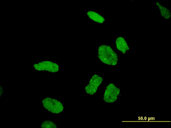 DDX11 monoclonal antibody (M03), clone 3C1