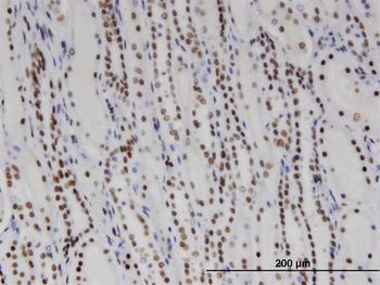 DDX11 monoclonal antibody (M03), clone 3C1