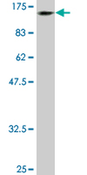 DDX11 monoclonal antibody (M03), clone 3C1