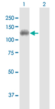 DDX11 purified MaxPab mouse polyclonal antibody (B01P)