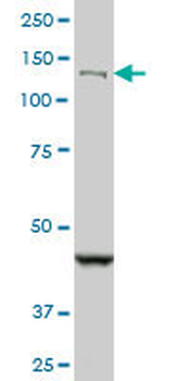 DHX8 monoclonal antibody (M07), clone 1D6