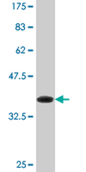 DHX8 monoclonal antibody (M07), clone 1D6